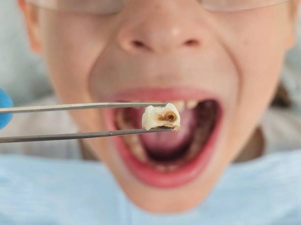 Best Weekend Emergency Dentist in Rancho Murieta, CA