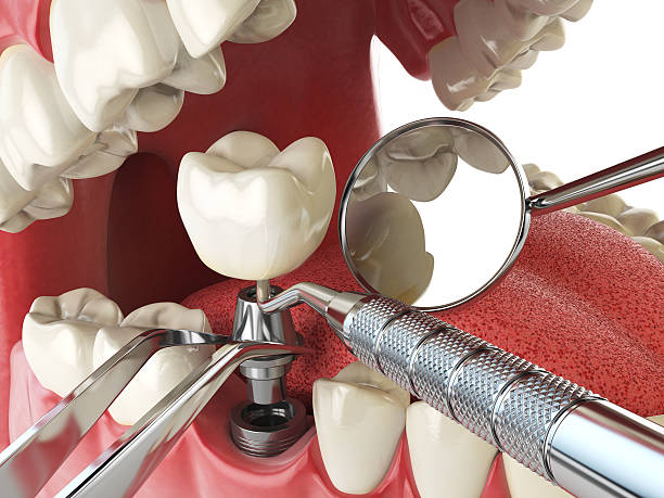 Best Pediatric Emergency Dentist in Rancho Murieta, CA